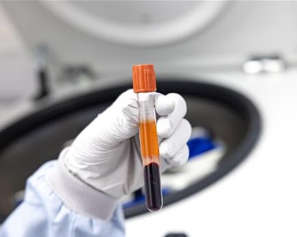 Blood 201029_react2_study_barclay_035