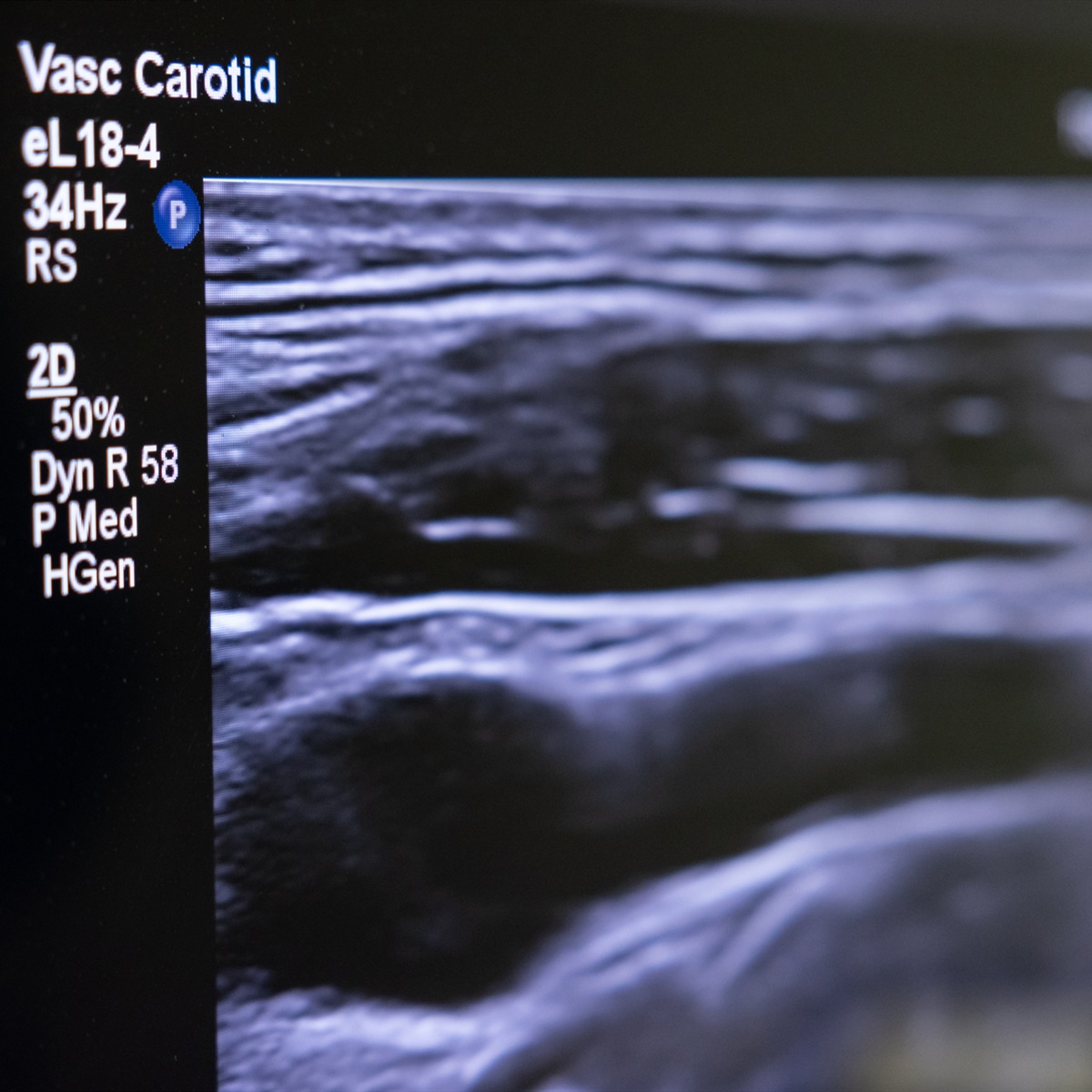 Ultrasound course run by the NHLI Ultrasound course run by the NHLI