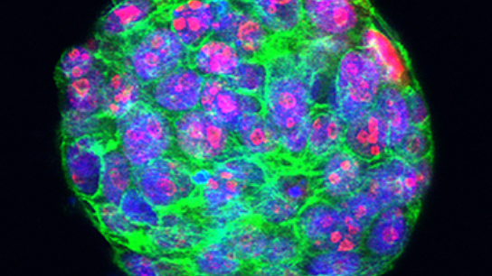 Proliferating cells in a tumour organoid of triple negative breast-cancer