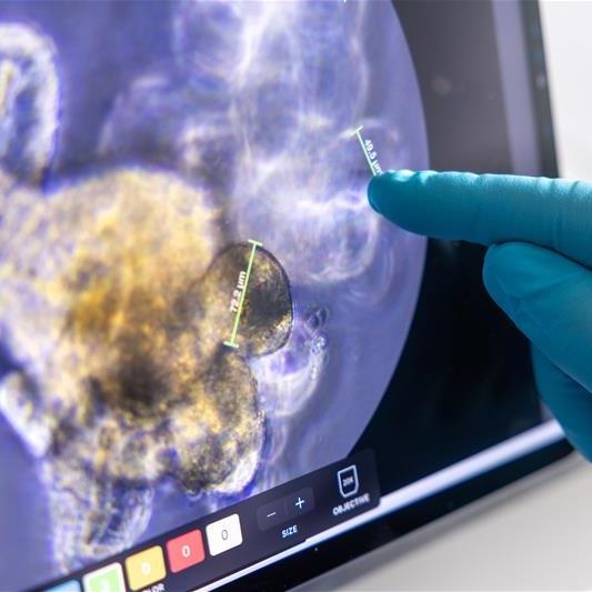 230704_tamas_korcsmaros_organoid_facility_031 230704_tamas_korcsmaros_organoid_facility_031
