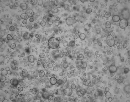 Pancreatic cancer organoids - microscopic view